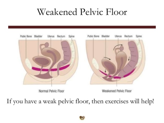 weakened pelvic floor